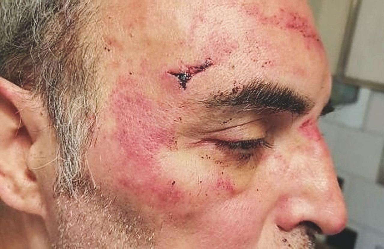 Copertina di “Brutto ricchione, adesso ti ammazziamo”: pestato in cortile (e il condominio fa il tifo)