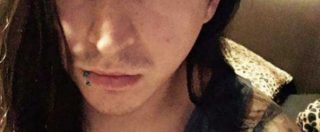 Copertina di Muore a 24 anni “sgozzato” dalla sigaretta elettronica: gli è esplosa in bocca