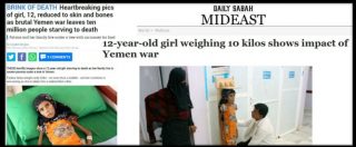 Copertina di Yemen, la foto di Fatima diventa simbolo della guerra: a 12 anni pesa solo 10 chili. Msf: ‘Mancano cibo, trasporti e medici’