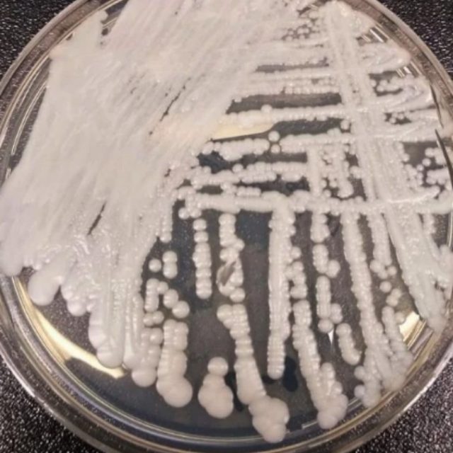 Candida auris, l’articolo sul New York Times preoccupa gli Usa: “Si sta diffondendo un fungo resistente agli antibiotici che uccide in 90 giorni”