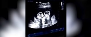 Copertina di Le gemelline “giocano” nella pancia della mamma: l’ecografia poco prima della nascita è straordinaria