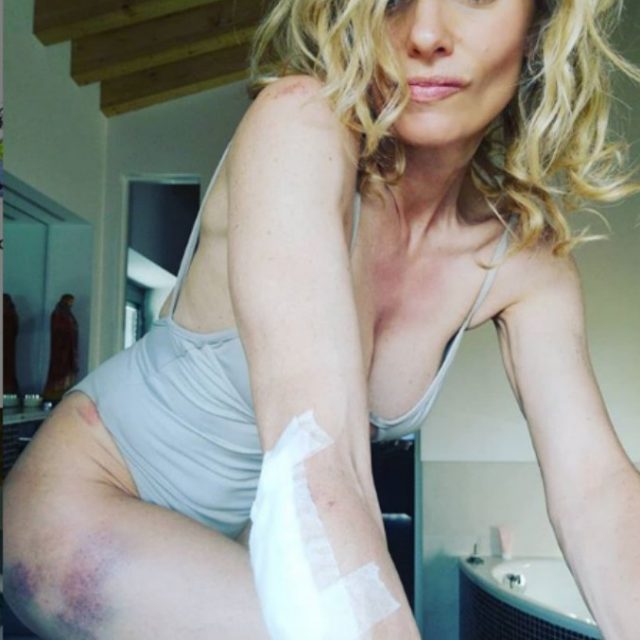Justine Mattera, brutta caduta in bici con Francesco Moser: “Ho fatto un volo, ma un volo che pensavo di essermi spaccata il gomito”