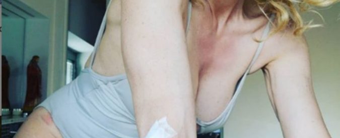 Justine Mattera, brutta caduta in bici con Francesco Moser: “Ho fatto un volo, ma un volo che pensavo di essermi spaccata il gomito”