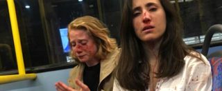 Copertina di Londra, coppia lesbica aggredita sul bus: “Volevano che ci baciassimo, poi i pugni”. Ci sono arresti per l’aggressione omofoba