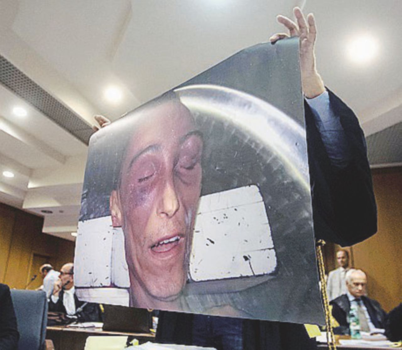 Processo Cucchi, i periti del gip: “Senza quella frattura Stefano non sarebbe morto”