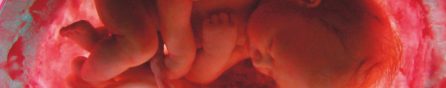 Copertina di Kustermann: “Con la sentenza della Cassazione sul feto a rischio il diritto della donna a dire no a un parto cesareo”