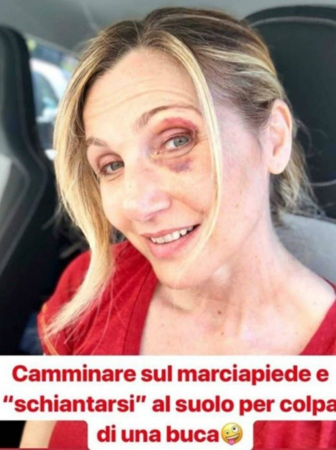 Lorella Cuccarini con il volto tumefatto: “Schiantata al suolo per colpa di una buca”