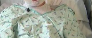 Ventenne salva la nipotina da un incendio, ustionato in tutto il corpo: “Lo rifarei anche se dovessi morire”