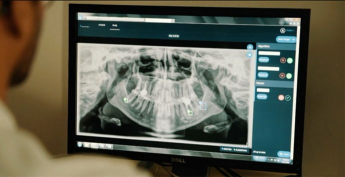 L’Intelligenza Artificiale può migliorare il lavoro del dentista. Provare per credere