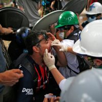 An injured demonstrator is assisted in Santiago, on October 25, 2019, a week after violence protests started. – Demonstrations against a hike in metro ticket prices in Chile’s capital exploded into violence on October 18, unleashing widening protests over living costs and social inequality. (Photo by Pablo VERA / AFP)