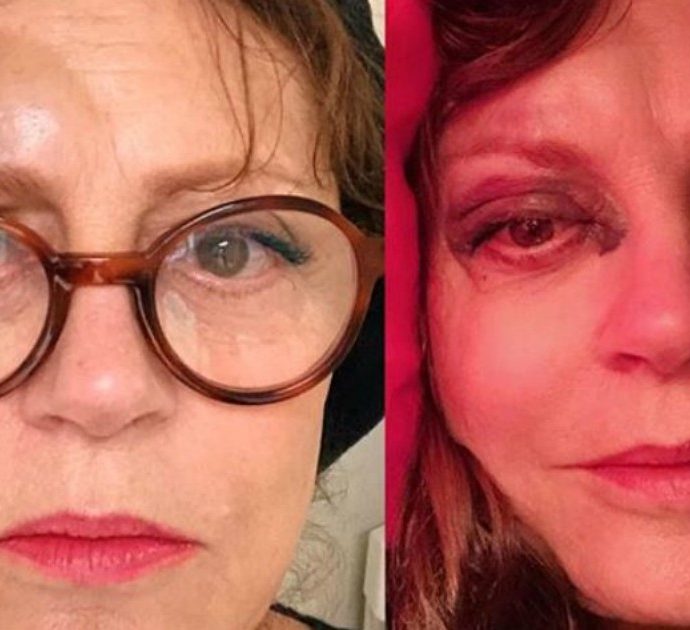 Susan Sarandon, brutta caduta per l’attrice premio Oscar: “Commozione cerebrale e naso fratturato”