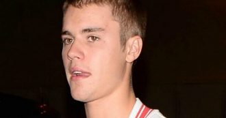 Copertina di Justin Bieber rivela: “Dicevano che sembravo una merda ma la verità è che ho la malattia di Lyme”. Ecco di cosa si tratta