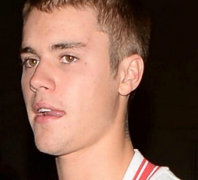 Justin Bieber rivela: “Dicevano che sembravo una merda ma la verità è che ho la malattia di Lyme”. Ecco di cosa si tratta