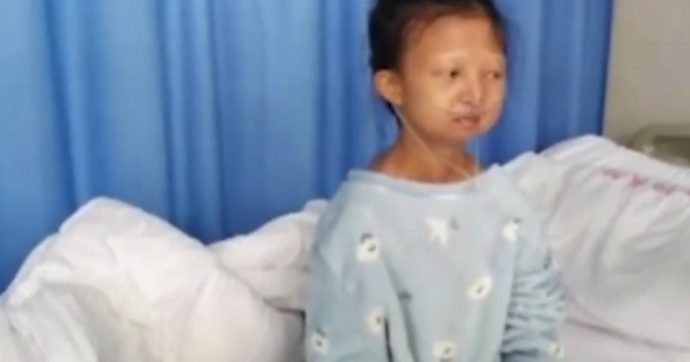Cina, muore per denutrizione a 24 anni: viveva con 20 centesimi al giorno per pagare le cure del fratello disabile