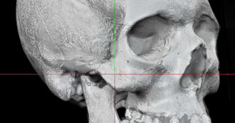 Copertina di Il mistero del cranio conservato all’Accademia di Arte Sanitaria di Roma: “Potrebbe essere di Plinio il Vecchio”