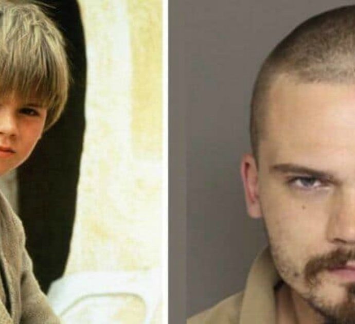Star Wars, che fine ha fatto l’attore che interpretò Anakin Skywalker? “Soffre di anosognosia e schizofrenia paranoica, è ricoverato in una clinica”