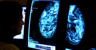Crescono i casi di tumore rispetto al 2019: sono 377mila. L’aumento colpisce solo le donne. Speranza: “Tanto lavoro da fare”