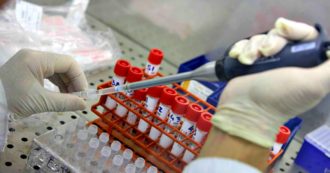 Copertina di Aids, “un vaccino anti Hiv genera una risposta anticorpale nel 97% dei casi”