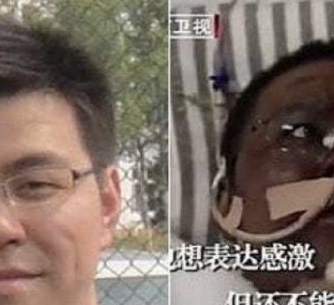 Ecco come stanno le cose sui medici cinesi malati di covid-19 fotografati con il viso nero