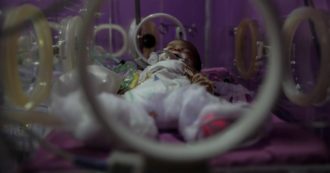 Copertina di Sindrome Kawasaki causata dal Covid: allarme sui bambini