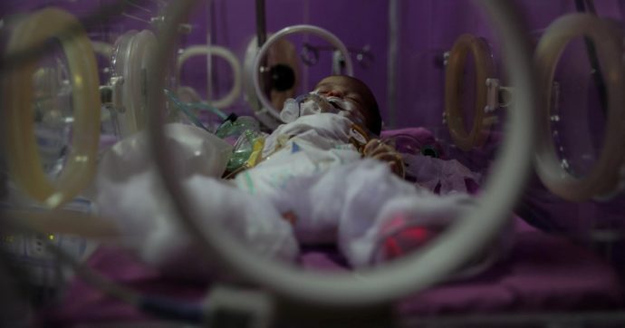 Sindrome Kawasaki causata dal Covid: allarme sui bambini