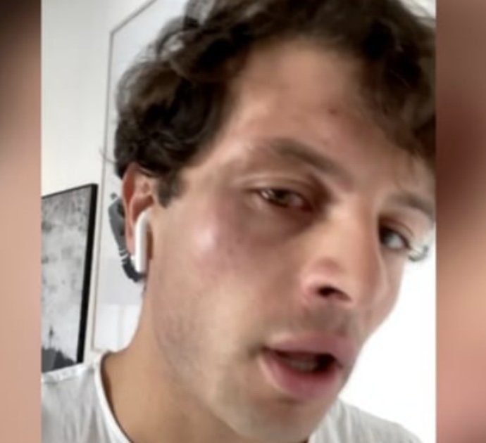 L’influencer Marco Ferrero (Iconize) picchiato per strada: “Tre ragazzini mi hanno chiesto una sigaretta. Poi mi hanno urlato “froc**” e dato un pugno”