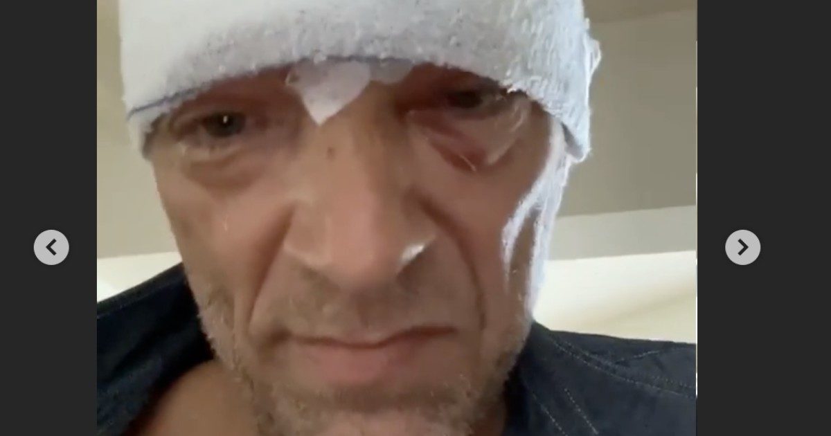 Vincent Cassel coinvolto in un incidente con il suo scooter, in ospedale con trauma cranico: “Sono vivo”. La foto con la testa completamente fasciata