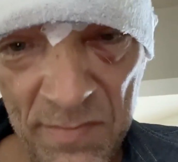 Vincent Cassel coinvolto in un incidente con il suo scooter, in ospedale con trauma cranico: “Sono vivo”. La foto con la testa completamente fasciata