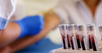 Copertina di Test sierologici, solo il 24% dei selezionati ha detto subito sì: la Croce Rossa proroga l’indagine epidemiologica fino a fine giugno