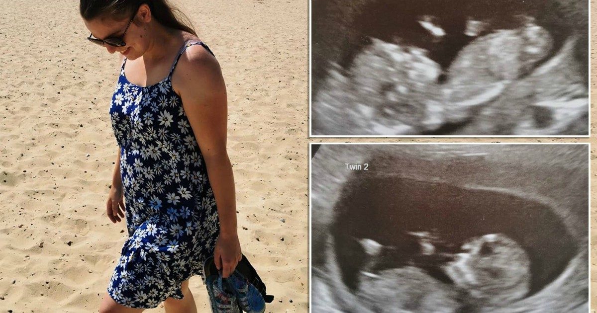 Donna incinta scopre di avere due uteri e in ognuno un gemello: “Succede una volta su 50 milioni”