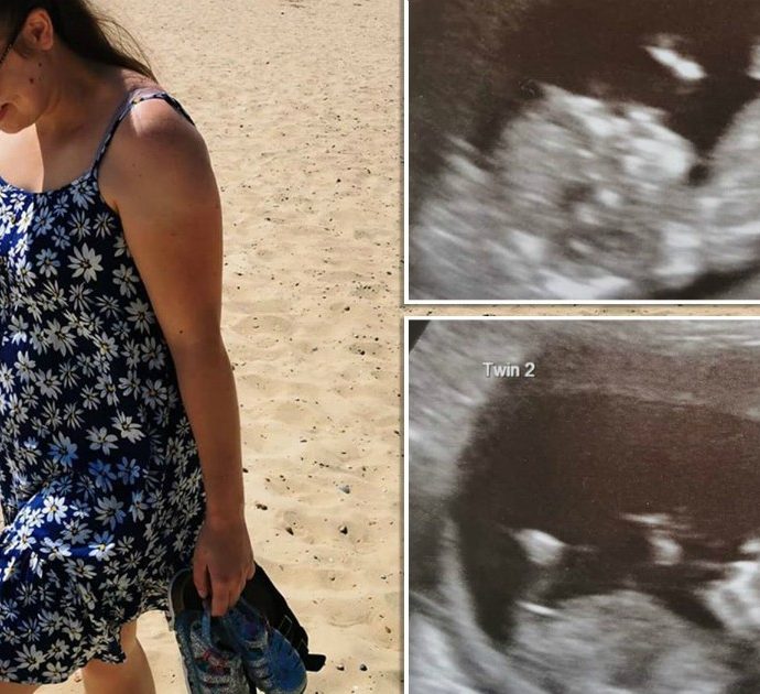 Donna incinta scopre di avere due uteri e in ognuno un gemello: “Succede una volta su 50 milioni”