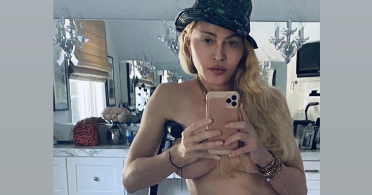 Madonna in topless e con la stampella: “Dietro la provocazione si nasconde un problema di salute”