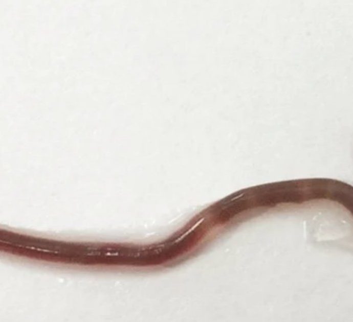 Mangia sashimi e si ritrova nella gola un “verme nero” di 38 mm