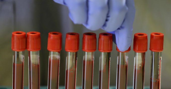 Vaccino Covid, in Australia positivi i primi test sull’uomo: “Genera risposta immunitaria, nessun effetto collaterale significativo”