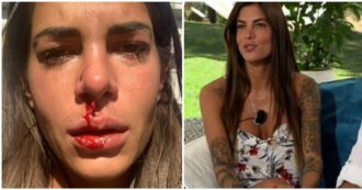 Copertina di Giada Giovanelli si mostra con il volto sanguinante: “Ecco mio padre. Mi sono rotta il ca**o di stare zitta”