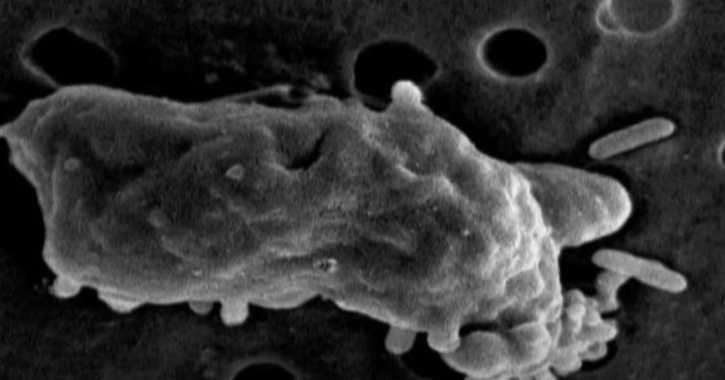 25enne contrae l’ameba mangia cervello e muore dopo un bagno nel lago di Tiberiade: è l’ennesimo caso in pochi mesi