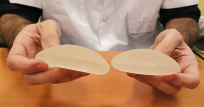 Copertina di Le protesi mammarie non sono la scelta giusta per le tutte le pazienti. Esiste la ricostruzione autologa