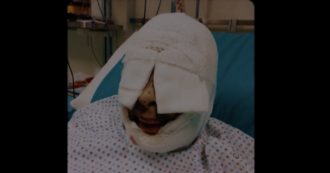 Gessica Notaro mostra in un video il suo volto prima e dopo l’aggressione: “Immagini forti ma servano da monito”