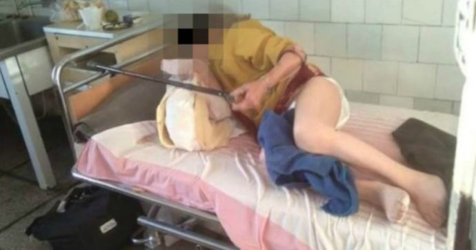 Nudi, sporchi e abbandonati nei corridoi: le immagini sulle terribili condizioni dei pazienti Covid in un ospedale della Romania