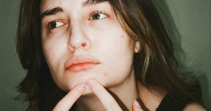 Si schiaccia un brufolo sul naso e il viso inizia a gonfiarsi: 17enne perde la vista