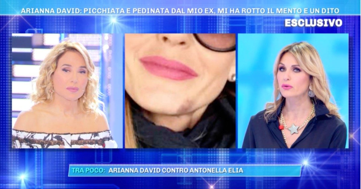 Arianna David mostra le foto delle violenze subite: “Mi ha puntato una pistola alla testa e picchiata con una mazza”