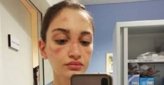 Copertina di Sanremo 2021, Alessia Bonari sul palco dell’Ariston: ecco chi è l’infermiera simbolo della prima ondata della pandemia di Covid