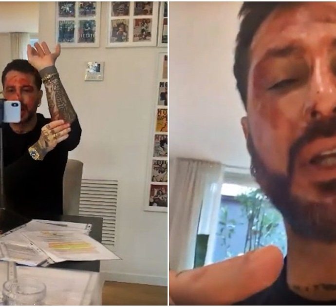 Fabrizio Corona si ferisce e mostra il sangue in un video pubblicato sui social: “Avete creato un mostro”