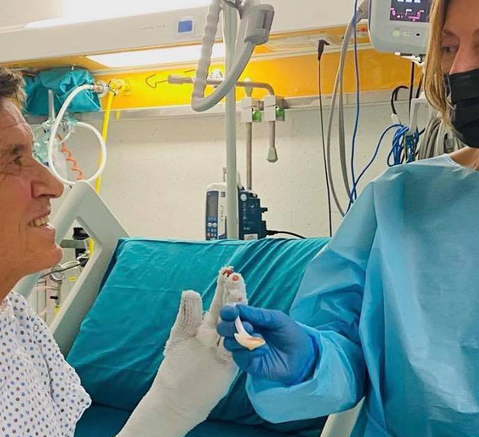 Gianni Morandi dimesso dall’ospedale dopo un mese di ricovero per le ustioni: “Adesso riabilitazione per recuperare l’uso della mano destra”