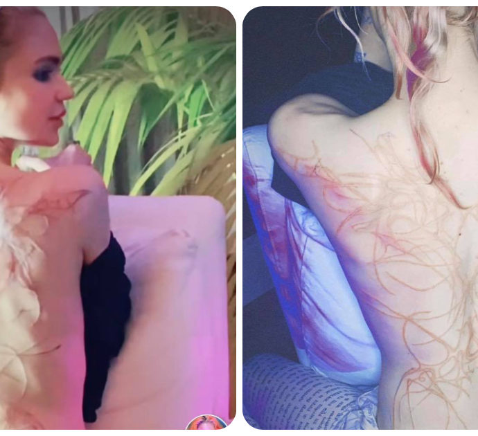 Grimes, la moglie di Elon Musk mostra per la prima volta le “cicatrici aliene” sulla sua schiena
