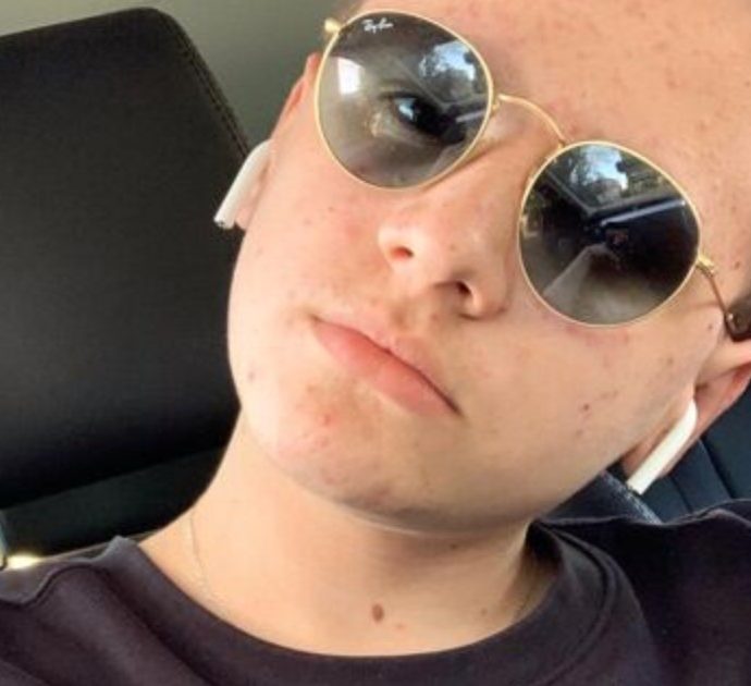 Morto Riccardo Coman, il 17enne star di TikTok che raccontava sui social la sua battaglia contro il cancro