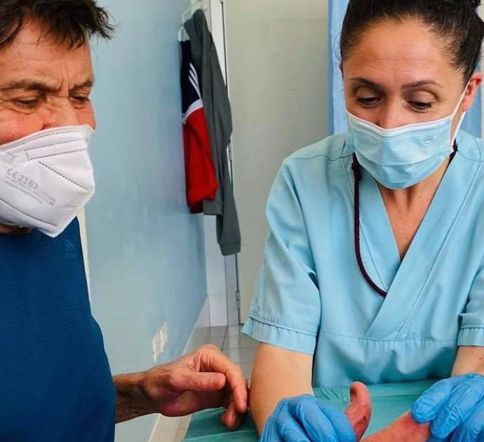 Gianni Morandi mostra per la prima volta la mano ustionata senza benda: “Quasi priva di mobilità”