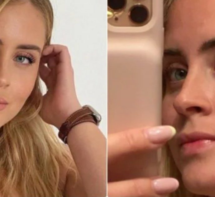 Valentina Ferragni: “Ci sono giorni in cui non vedo miglioramenti e la malattia si fa sentire. Ma sono orgogliosa di me stessa”