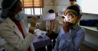 Copertina di India, oltre al Covid-19 è allarme per il ‘fungo nero’ tra i guariti: in Rajasthan è “epidemia”