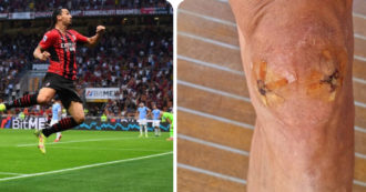 Copertina di Ibrahimovic, sui social la foto dell’infortunio al ginocchio di maggio: così lo svedese celebra il ritorno al gol contro la Lazio